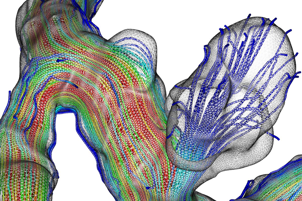 Detailaufnahme einer Strömungssimulation eines Blutgefäßes